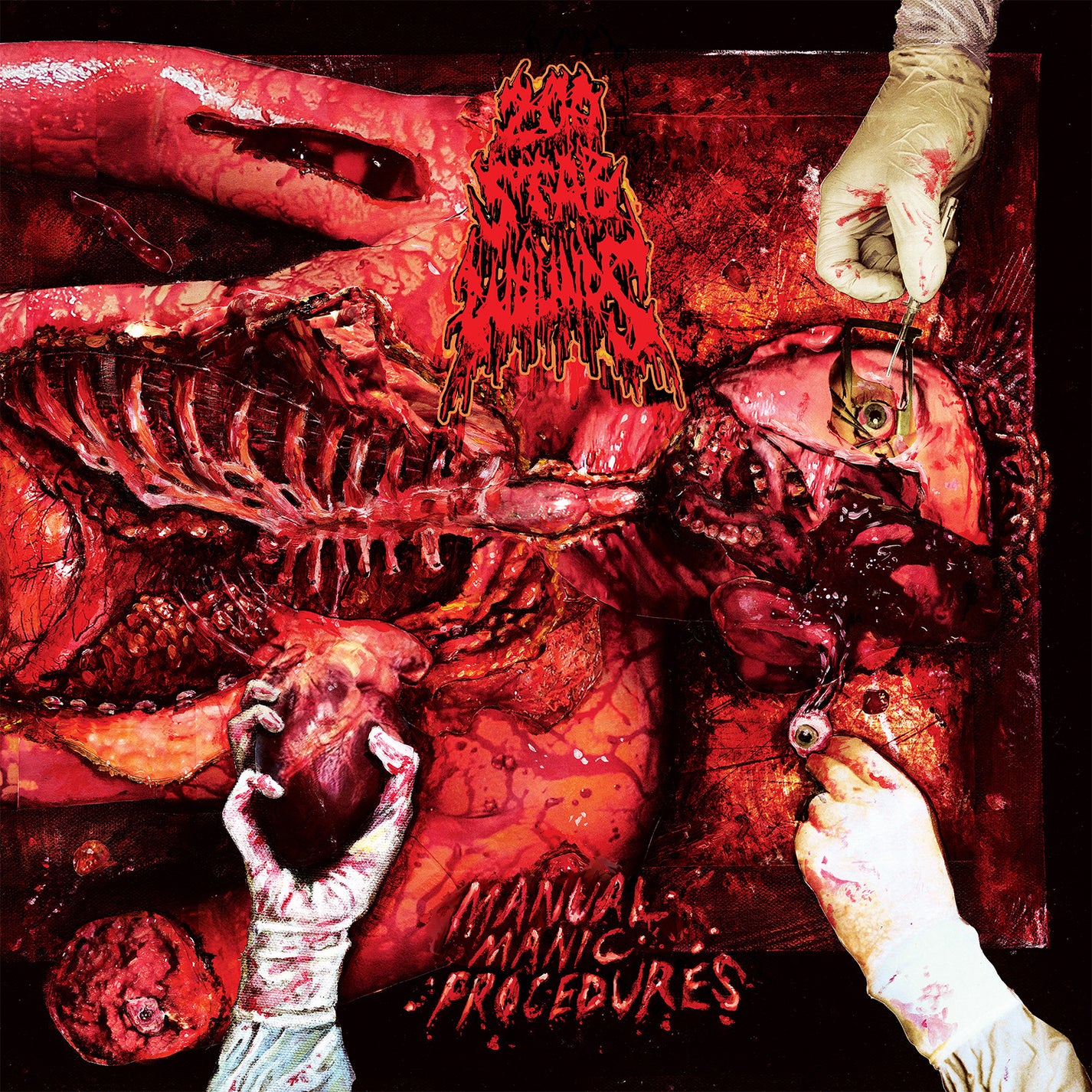 200 STAB WOUNDS &quot;Manual Manic Procedures&quot; LP